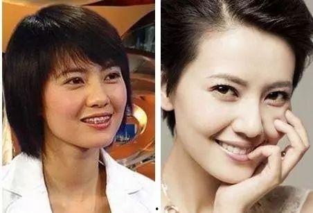 明星整容都去哪家,哪家医院最受追捧？